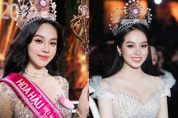 Các hoa hậu, á hậu thừa nhận phẫu thuật thẩm mỹ